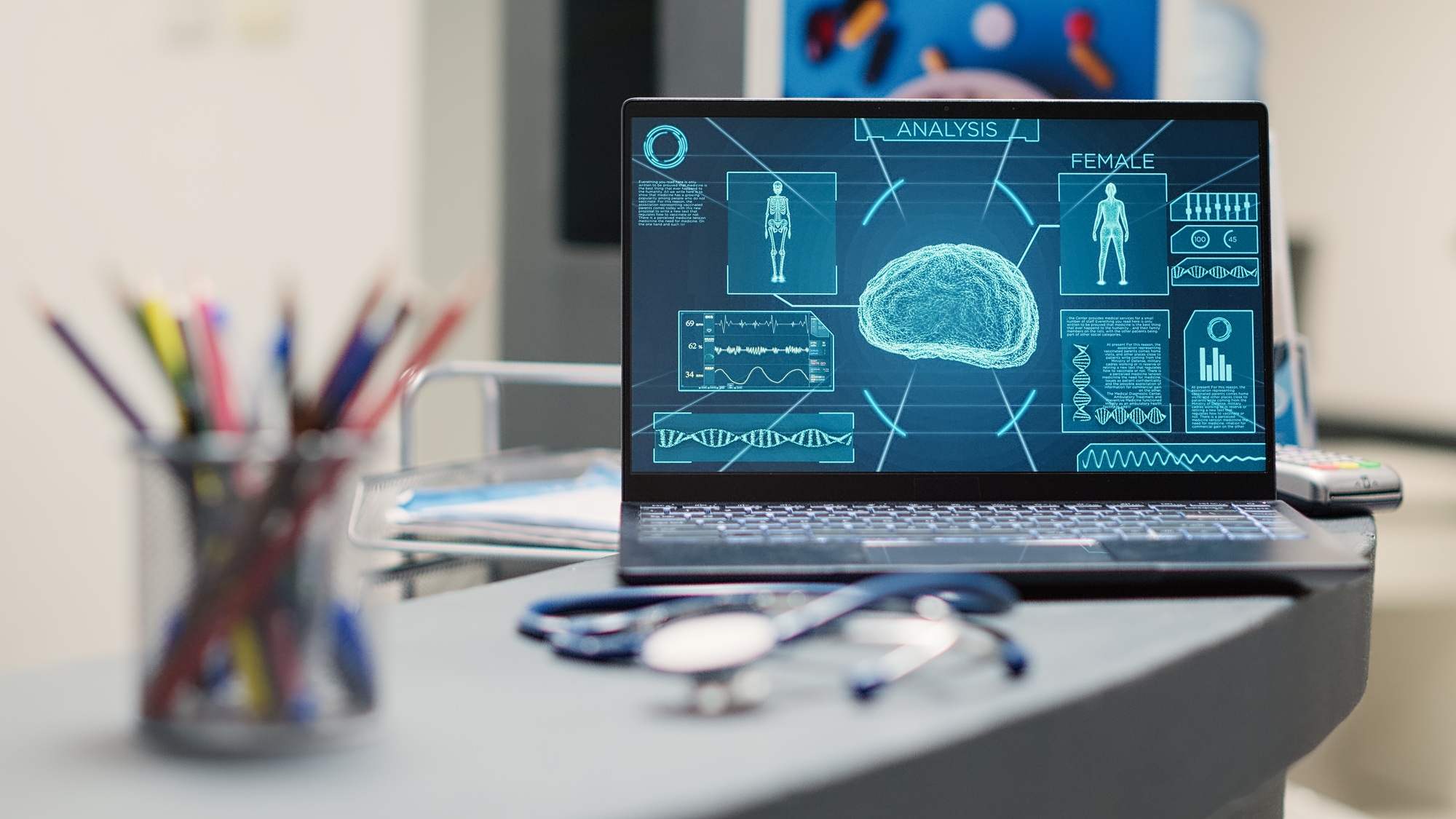 Laptop with human brain scan on desk